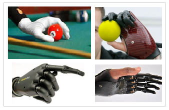 Arm and hand Prostheses